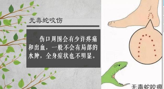 （男子在湖边被蛇咬伤视频）